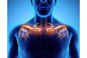 Clavicle Fractures: What Victims Should Expect