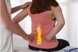 The Link Between Spinal Cord Injuries and Paralysis
